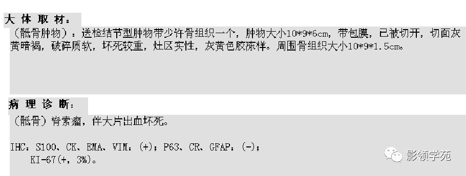 影像PPT - 7种骶骨肿瘤影像表现-5 影像PPT - 7种骶骨肿瘤影像表现-5