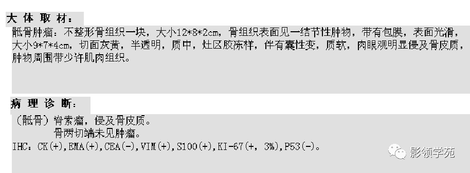 影像PPT - 7种骶骨肿瘤影像表现-9 影像PPT - 7种骶骨肿瘤影像表现-9