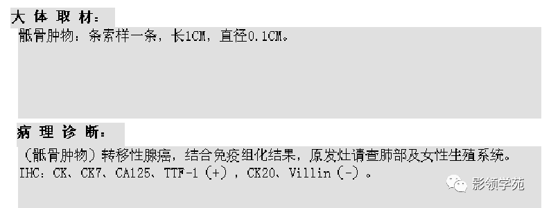 影像PPT - 7种骶骨肿瘤影像表现-21 影像PPT - 7种骶骨肿瘤影像表现-21