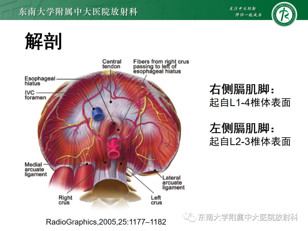 影像PPT - 【PPT】正中弓状韧带压迫综合征（ MALS ）-5