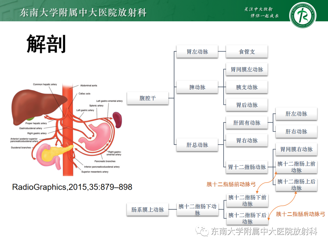 影像PPT - 【PPT】正中弓状韧带压迫综合征（ MALS ）-7