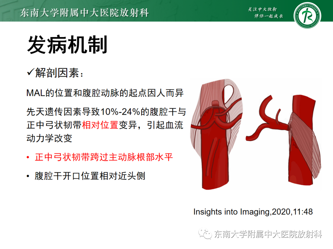 影像PPT - 【PPT】正中弓状韧带压迫综合征（ MALS ）-9