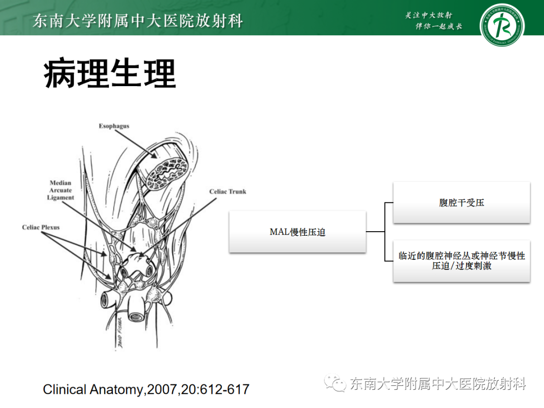 影像PPT - 【PPT】正中弓状韧带压迫综合征（ MALS ）-11