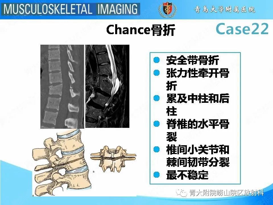 影像PPT - 【PPT】Hangman骨折-22