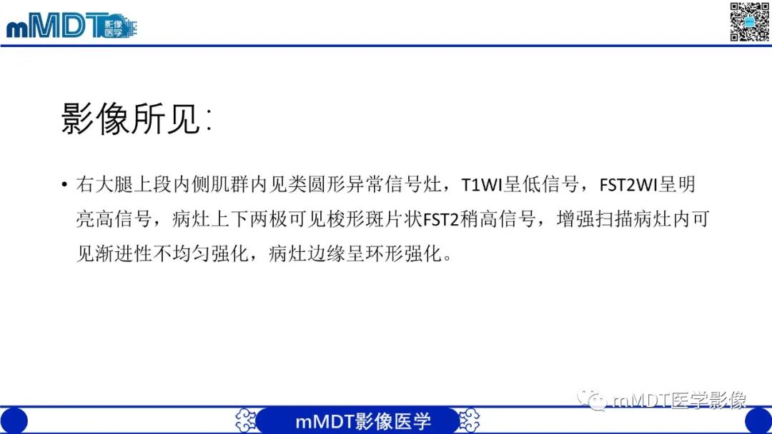 影像PPT - 【PPT】肌内粘液瘤的MRI表现-7 影像PPT - 【PPT】肌内粘液瘤的MRI表现-7