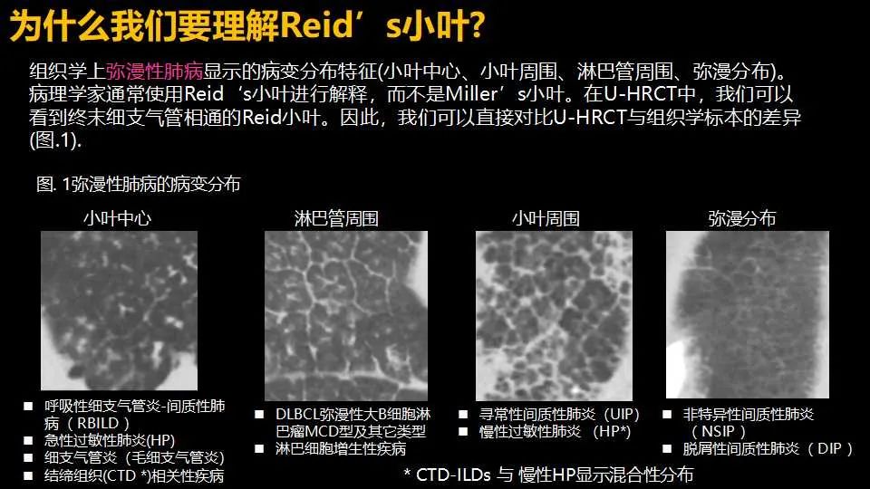 影像PPT - 【PPT】超高分辨率CT(U-HRCT)对弥漫性肺部疾病的放射-病理相关性探究：从Miller\'s到Reid\'s小叶-3