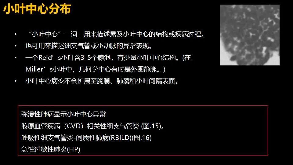 影像PPT - 【PPT】超高分辨率CT(U-HRCT)对弥漫性肺部疾病的放射-病理相关性探究：从Miller\'s到Reid\'s小叶-20