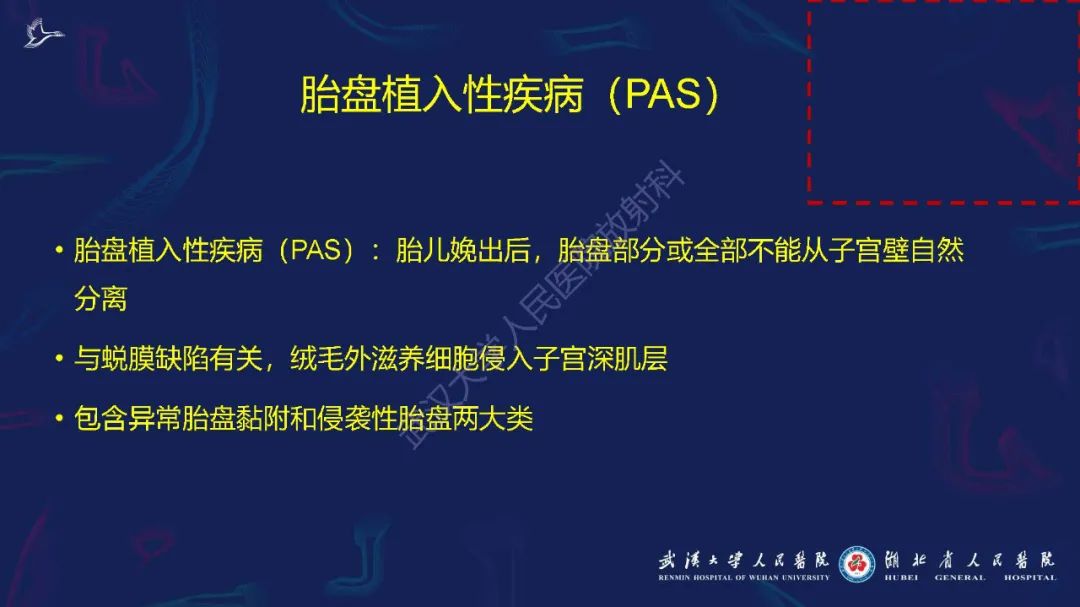 影像PPT - 【PPT】胎盘植入性疾病MRI诊断-3