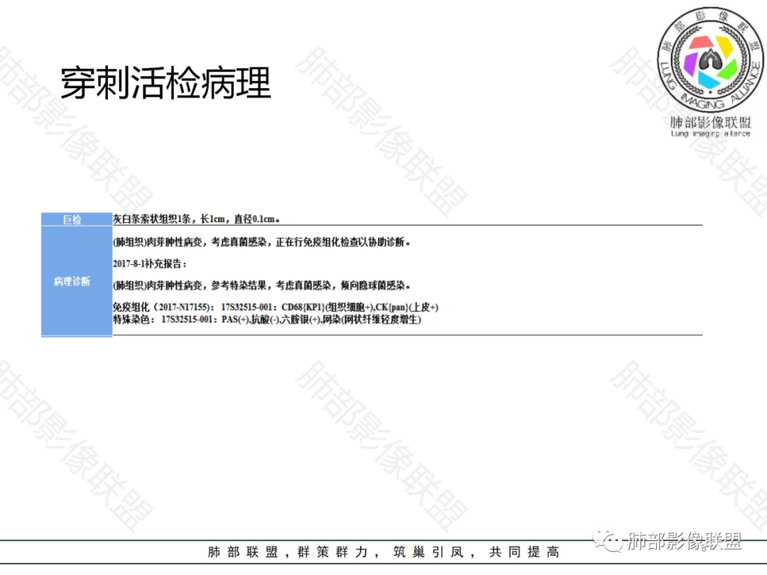 影像PPT - 【病例】以大片肺实变影为主要表现的肺隐球菌感染1例CT-27 影像PPT - 【病例】以大片肺实变影为主要表现的肺隐球菌感染1例CT-27