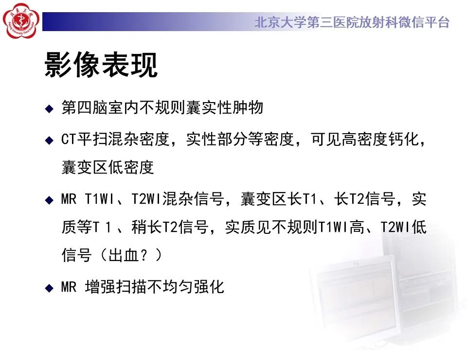 影像PPT - 【病例】四脑室毛细胞型星形细胞瘤1例MR影像-14