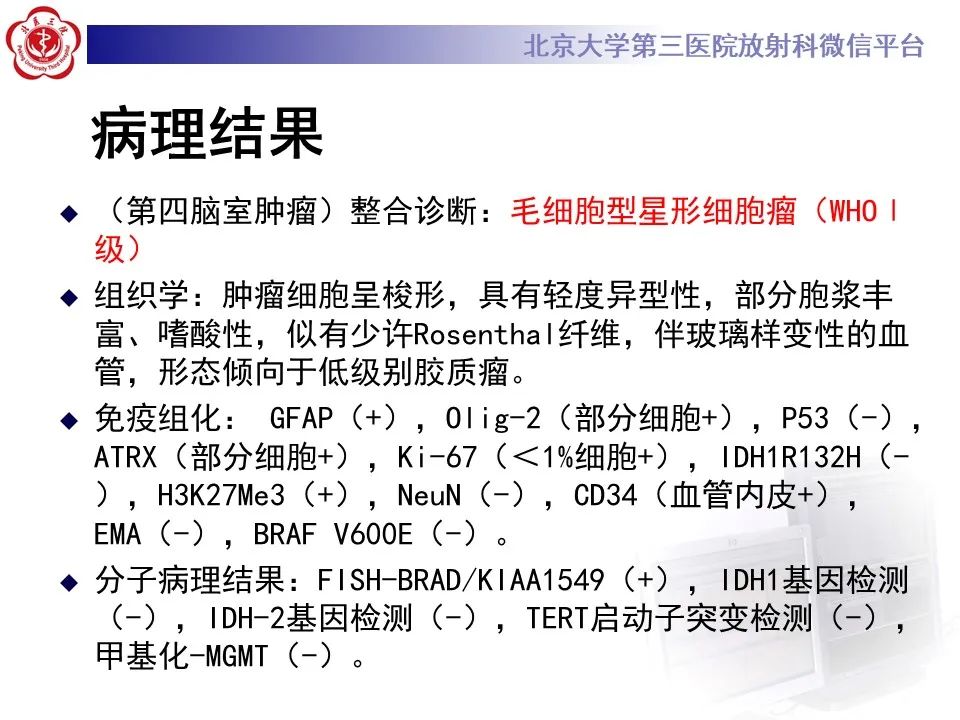 影像PPT - 【病例】四脑室毛细胞型星形细胞瘤1例MR影像-15