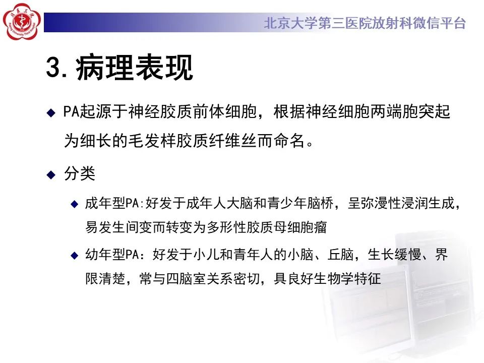 影像PPT - 【病例】四脑室毛细胞型星形细胞瘤1例MR影像-19