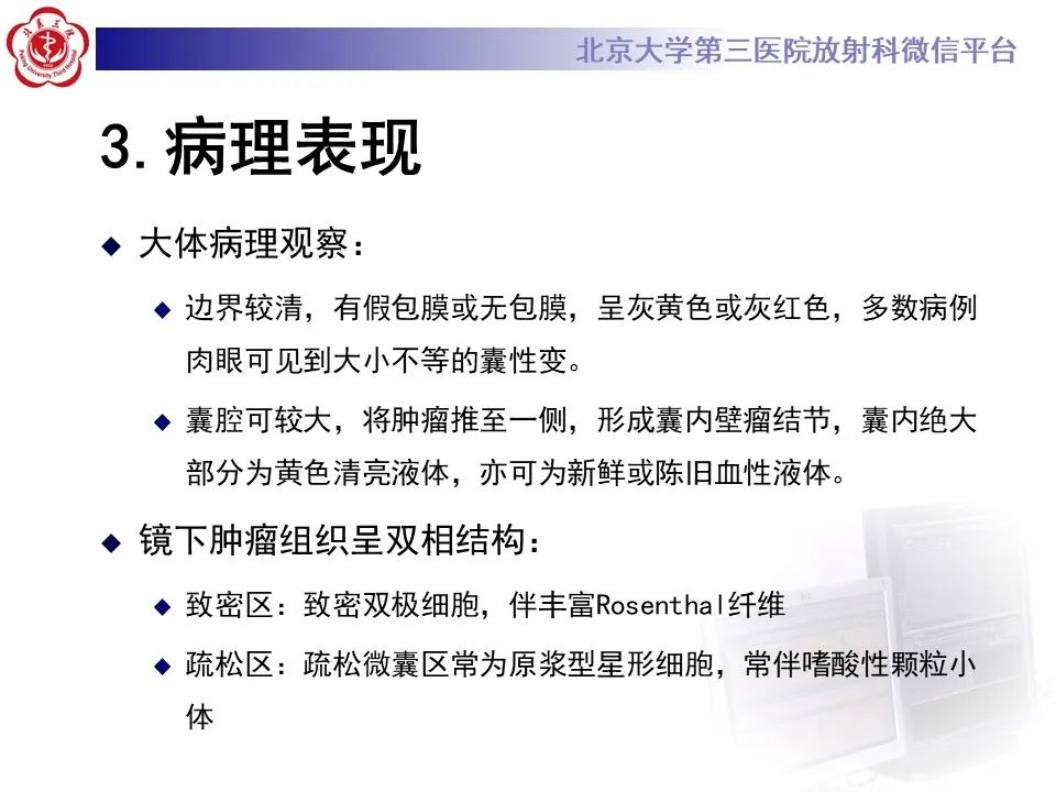 影像PPT - 【病例】四脑室毛细胞型星形细胞瘤1例MR影像-20