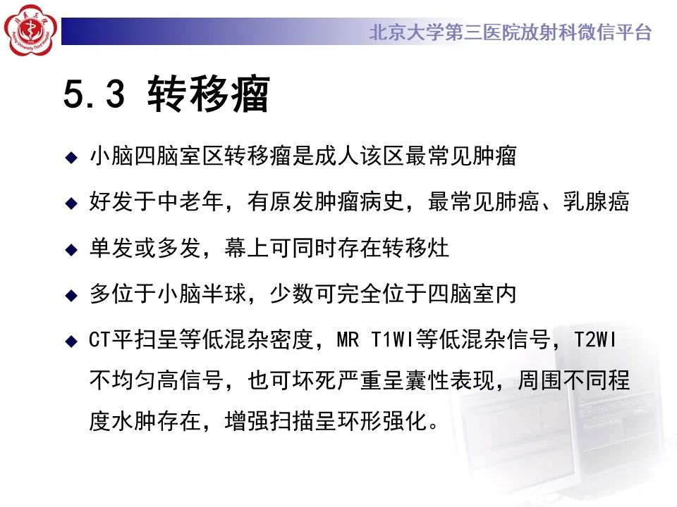 影像PPT - 【病例】四脑室毛细胞型星形细胞瘤1例MR影像-33
