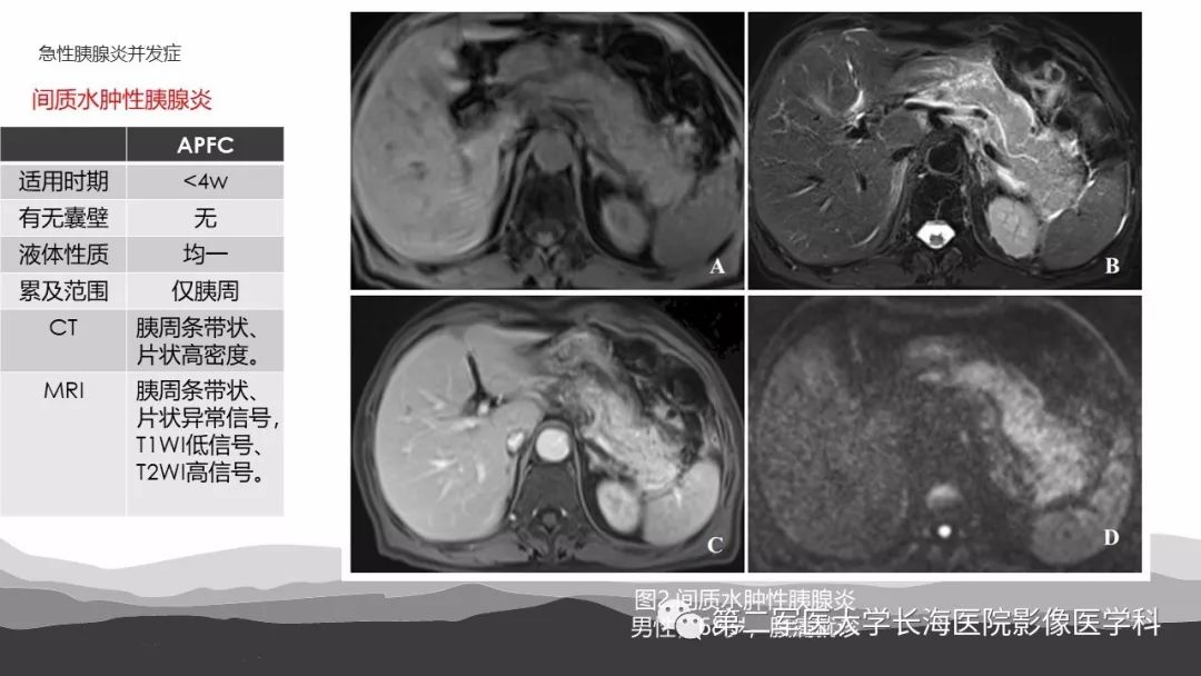 影像PPT - 【PPT】坏死性急性胰腺炎的影像，诊断，治疗-10