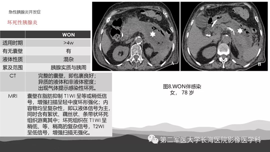 影像PPT - 【PPT】坏死性急性胰腺炎的影像，诊断，治疗-16
