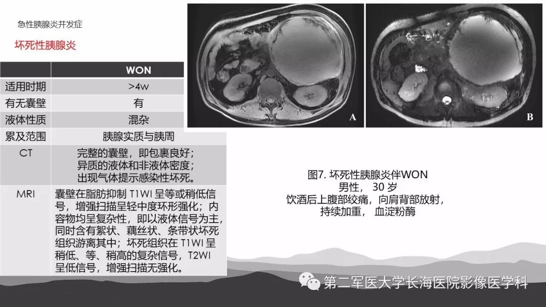 影像PPT - 【PPT】坏死性急性胰腺炎的影像，诊断，治疗-15