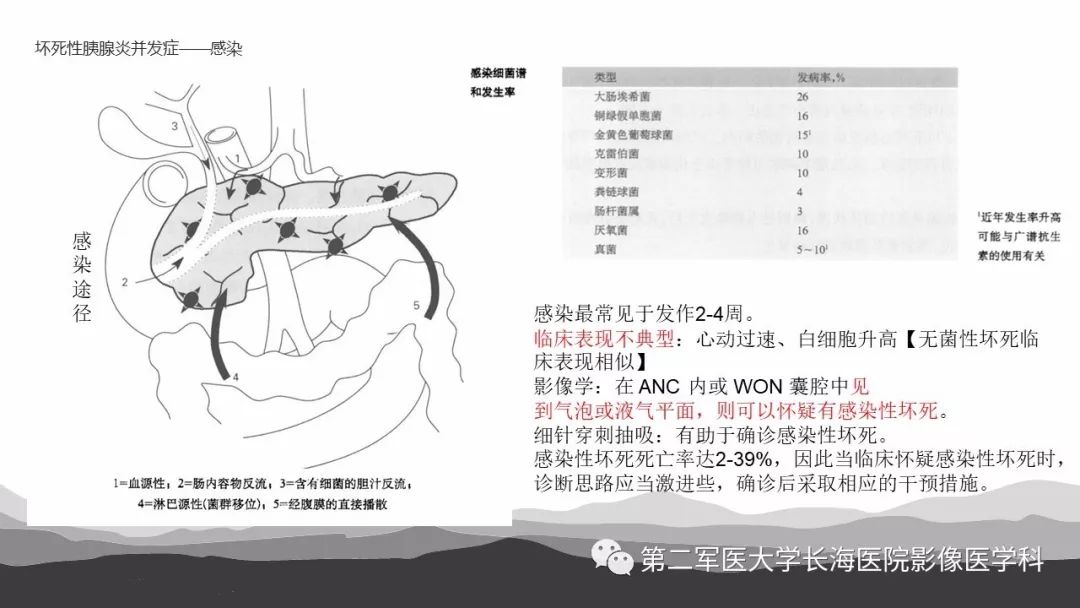 影像PPT - 【PPT】坏死性急性胰腺炎的影像，诊断，治疗-33