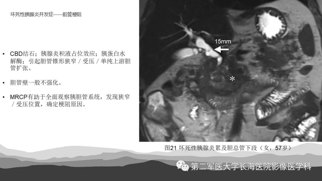 影像PPT - 【PPT】坏死性急性胰腺炎的影像，诊断，治疗-37