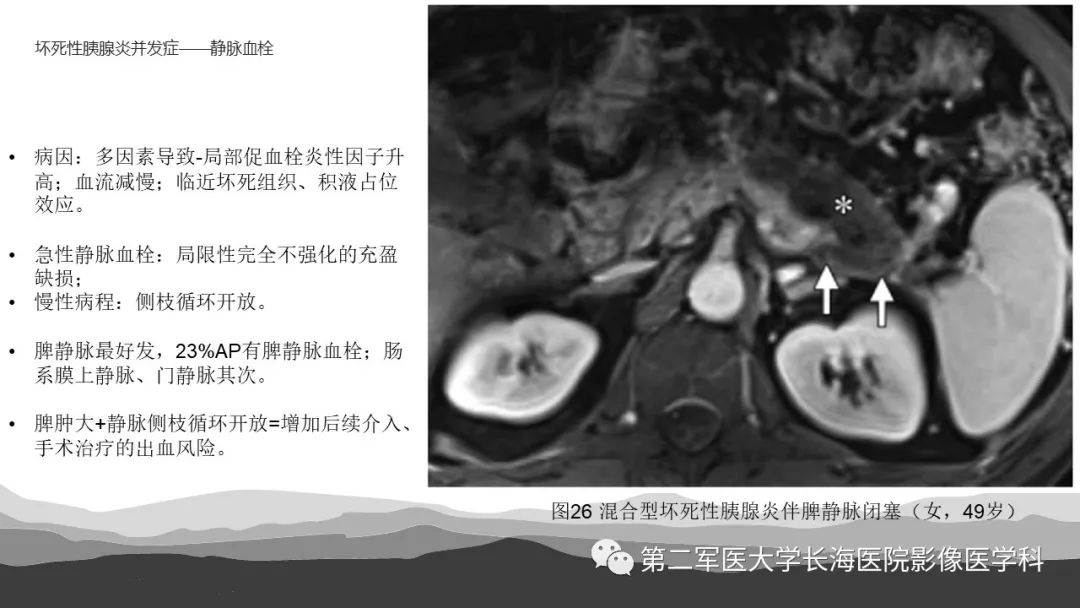 影像PPT - 【PPT】坏死性急性胰腺炎的影像，诊断，治疗-42