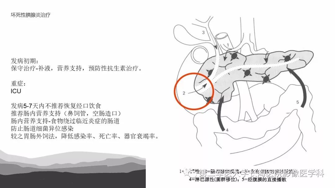 影像PPT - 【PPT】坏死性急性胰腺炎的影像，诊断，治疗-51