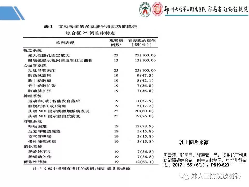 影像PPT - 【PPT】多系统平滑肌功能障碍综合征-21