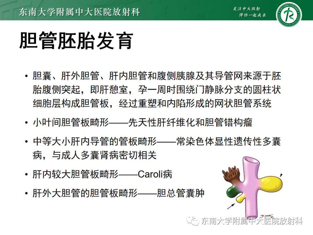 影像PPT - 【PPT】Caroli病-6 影像PPT - 【PPT】Caroli病-6