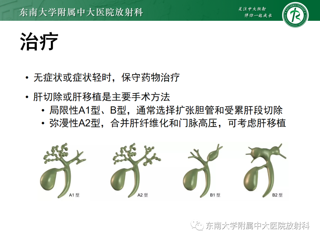 影像PPT - 【PPT】Caroli病-31 影像PPT - 【PPT】Caroli病-31