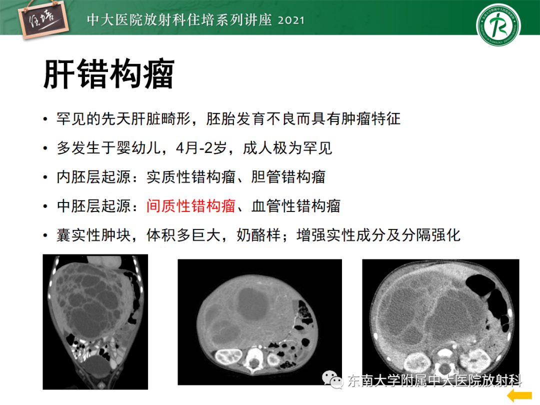 影像PPT - 【PPT】肝脏常见含脂病变-31