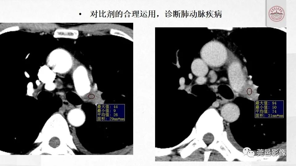 影像PPT - 【PPT】碘对比剂的应用及风险与处理-19