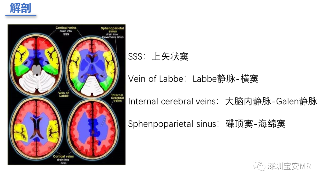 影像PPT - 【PPT】颅内静脉和静脉窦血栓形成-4