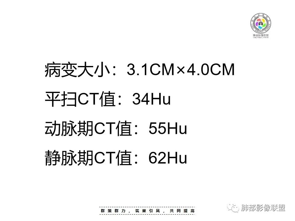 影像PPT - 【病例】罕见的食管神经鞘瘤-15