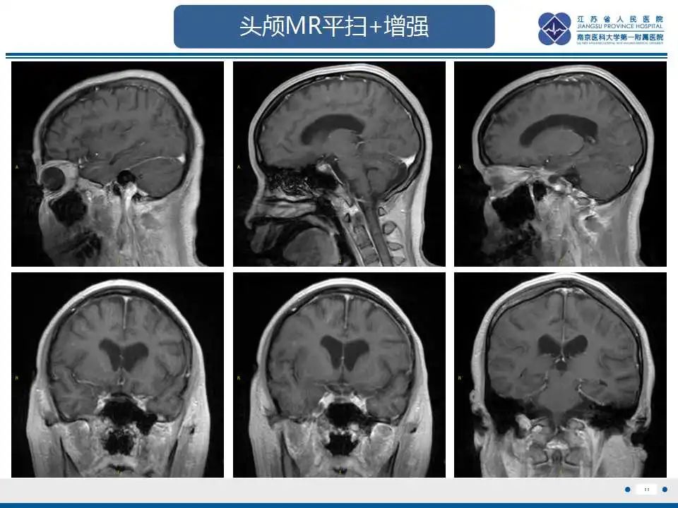 影像PPT - -13