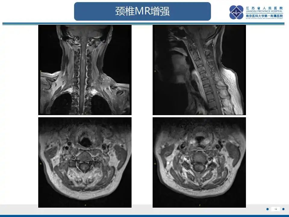 影像PPT - -14