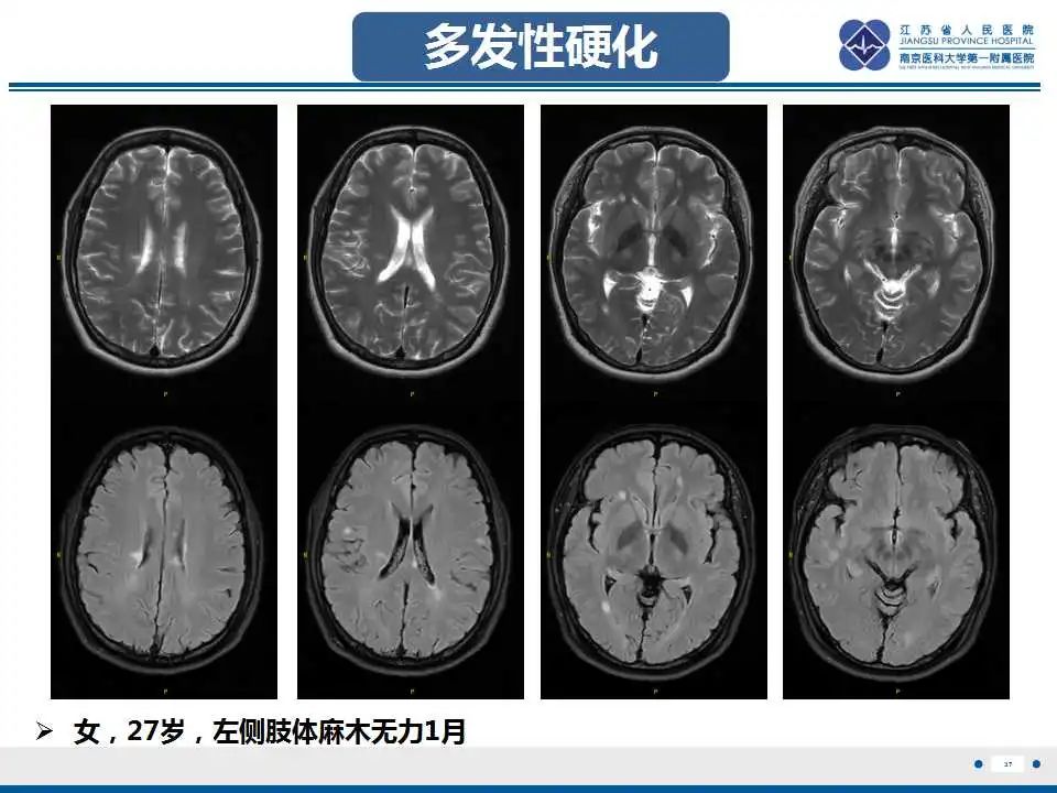 影像PPT - -39