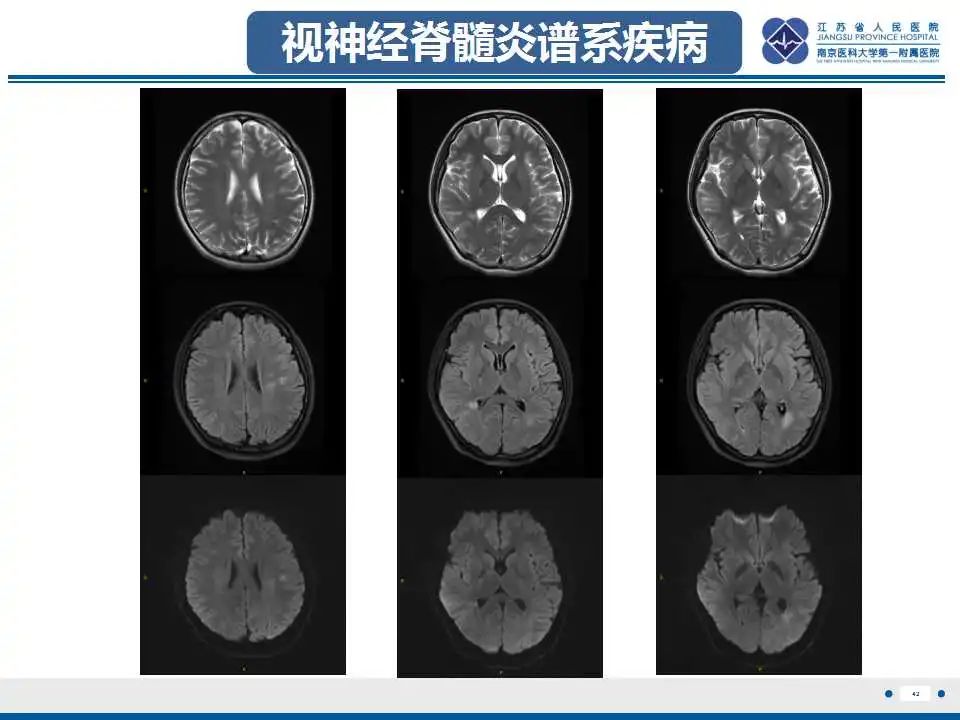 影像PPT - -44