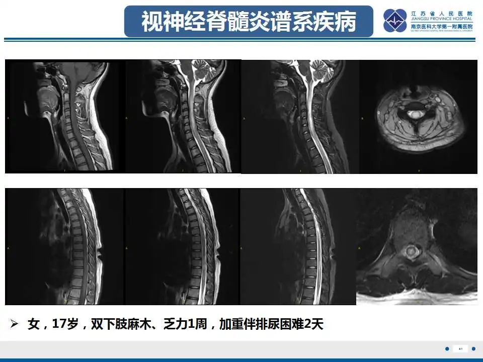 影像PPT - -43