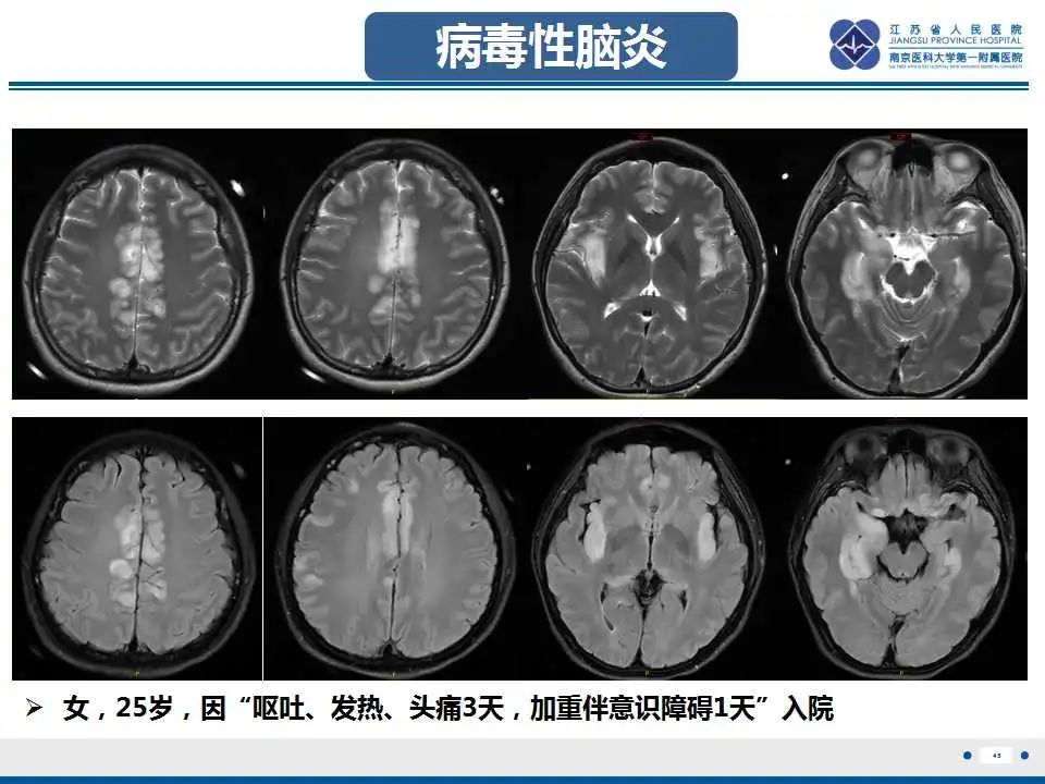 影像PPT - -47