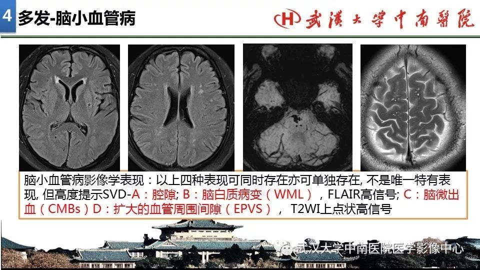 影像PPT - 【PPT】局灶性脑部病变影像诊断-27