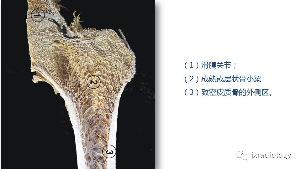 影像PPT - 【PPT】寻找骨折线：下肢应力性骨折的影像学检查-5