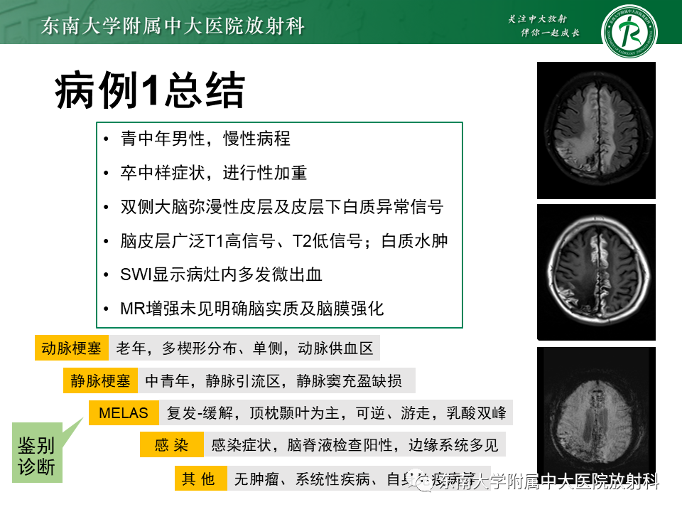 影像PPT - 【病例】原发性中枢神经系统血管炎(PACNS) VS 神经梅毒-12 影像PPT - 【病例】原发性中枢神经系统血管炎(PACNS) VS 神经梅毒-12