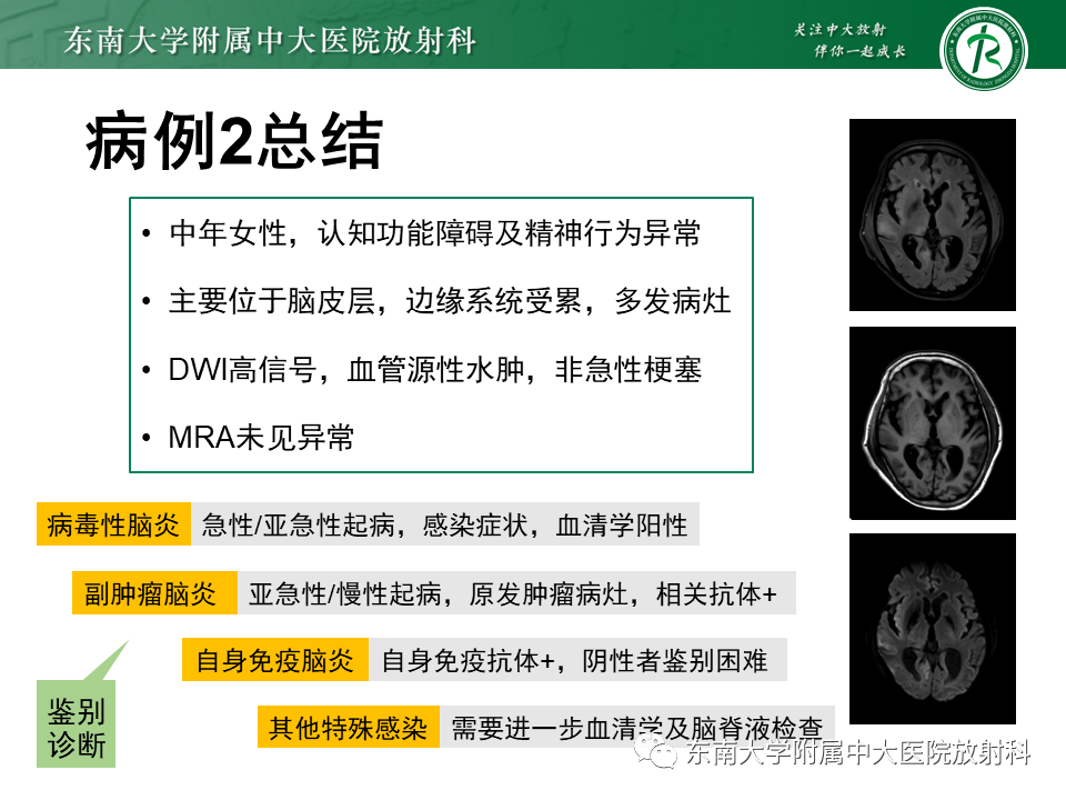 影像PPT - 【病例】原发性中枢神经系统血管炎(PACNS) VS 神经梅毒-17 影像PPT - 【病例】原发性中枢神经系统血管炎(PACNS) VS 神经梅毒-17