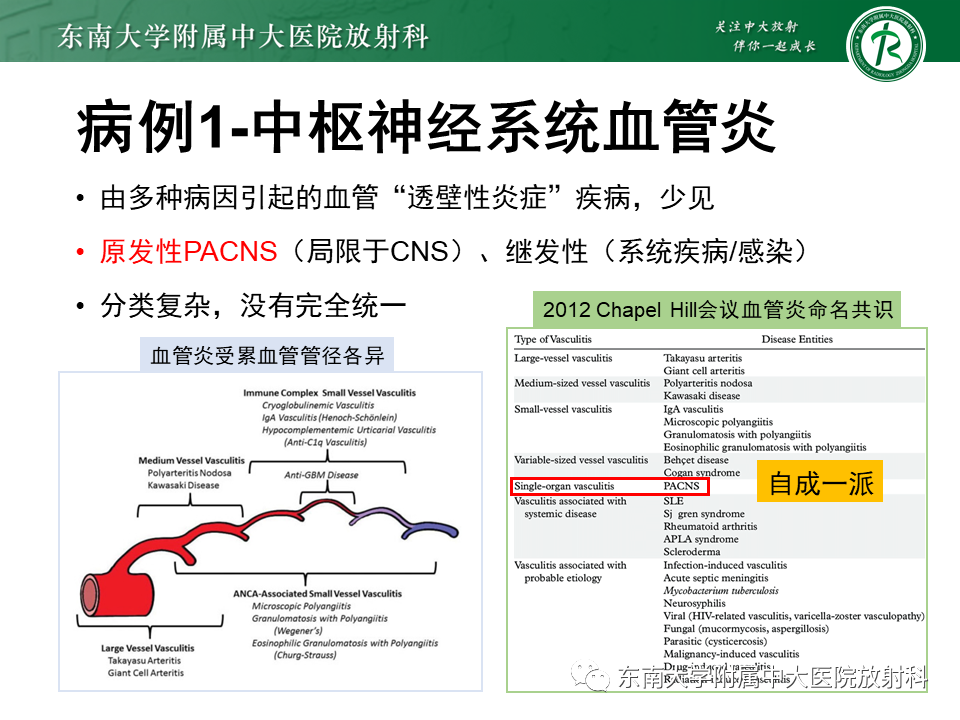 影像PPT - 【病例】原发性中枢神经系统血管炎(PACNS) VS 神经梅毒-22 影像PPT - 【病例】原发性中枢神经系统血管炎(PACNS) VS 神经梅毒-22