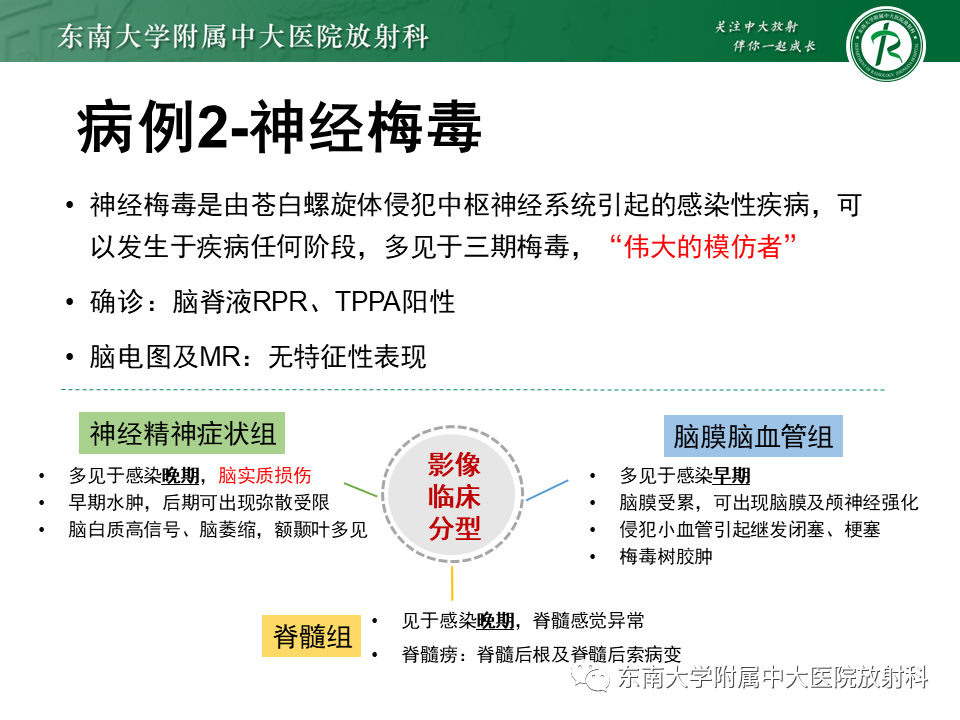 影像PPT - 【病例】原发性中枢神经系统血管炎(PACNS) VS 神经梅毒-25 影像PPT - 【病例】原发性中枢神经系统血管炎(PACNS) VS 神经梅毒-25