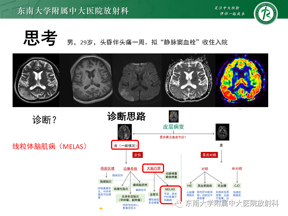 影像PPT - 【病例】原发性中枢神经系统血管炎(PACNS) VS 神经梅毒-35 影像PPT - 【病例】原发性中枢神经系统血管炎(PACNS) VS 神经梅毒-35