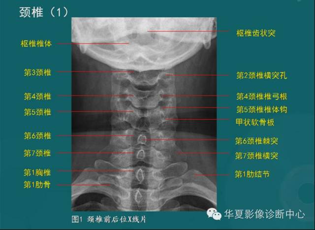 影像PPT - 史上最全断层解剖图谱-6