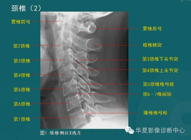影像PPT - 史上最全断层解剖图谱-7