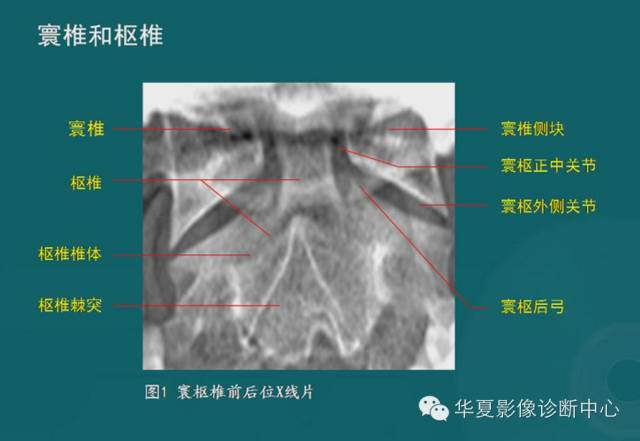 影像PPT - 史上最全断层解剖图谱-8