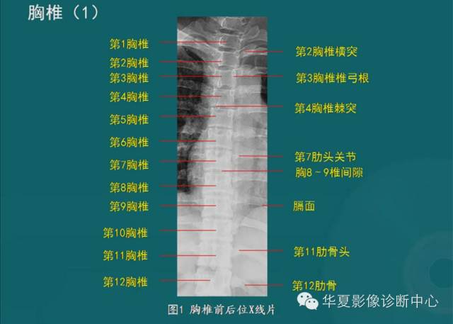 影像PPT - 史上最全断层解剖图谱-9