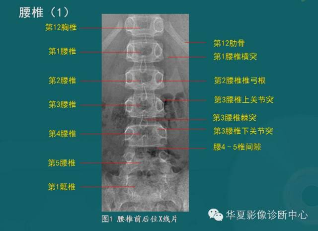 影像PPT - 史上最全断层解剖图谱-11